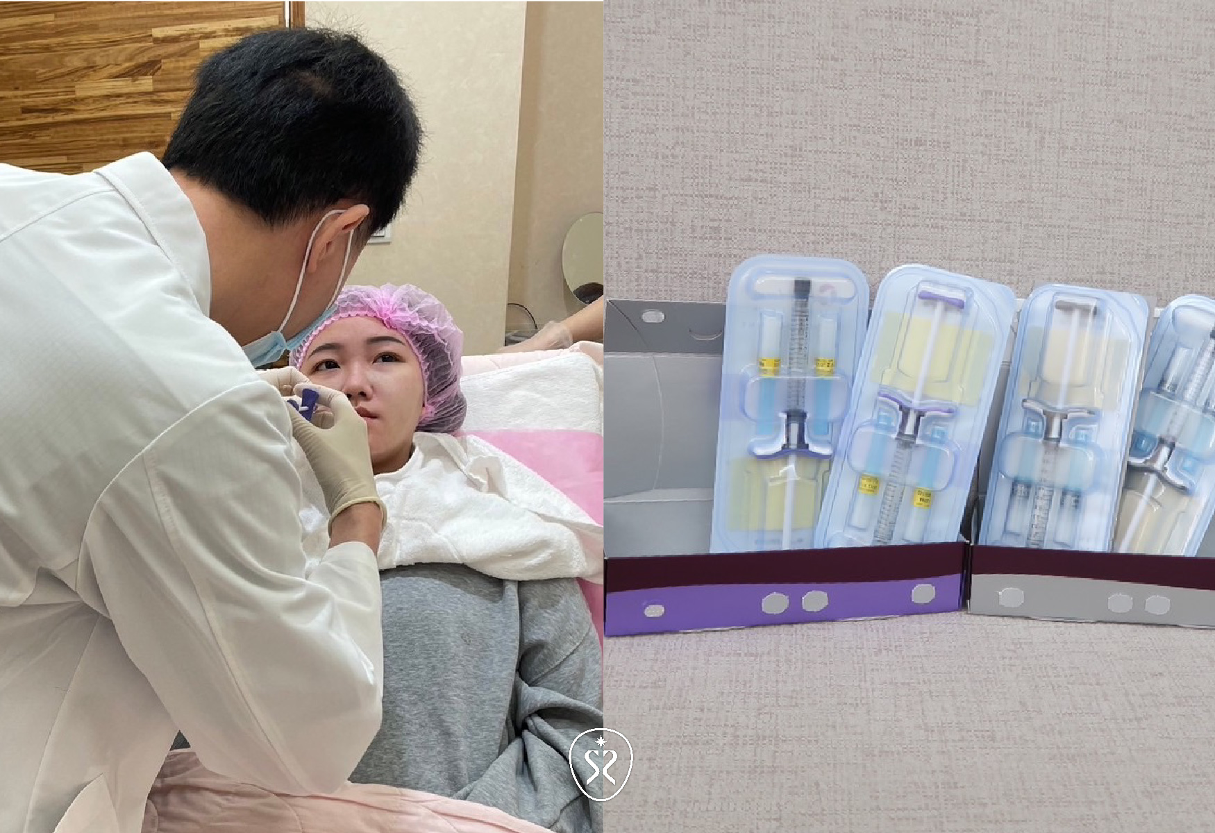 喬雅登玻尿酸效果好，支撐度佳，值得推薦